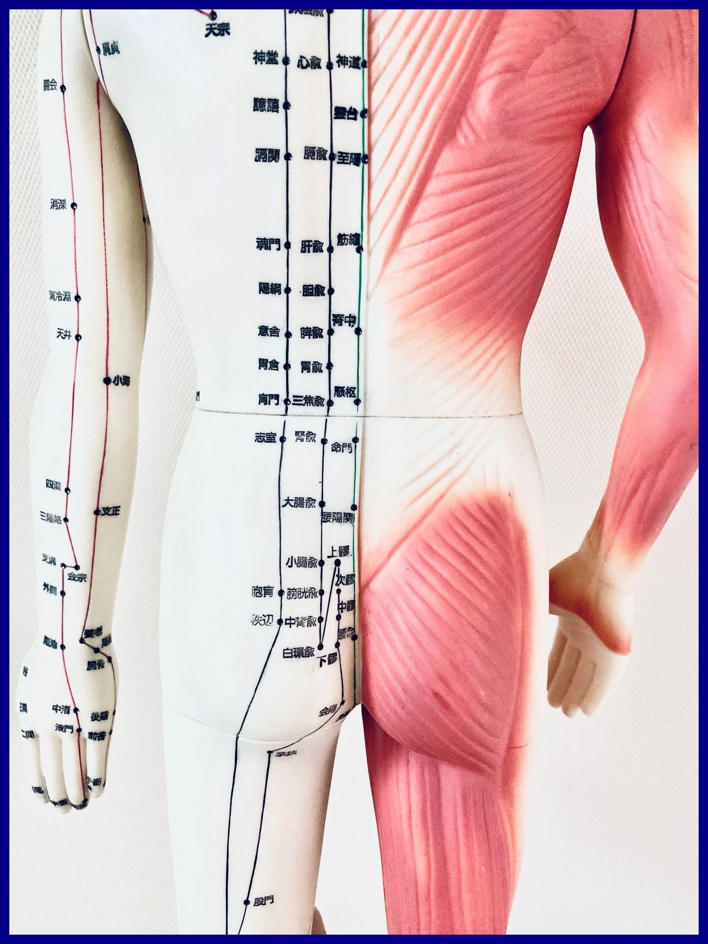 背部 腰臀部 刺鍼部位